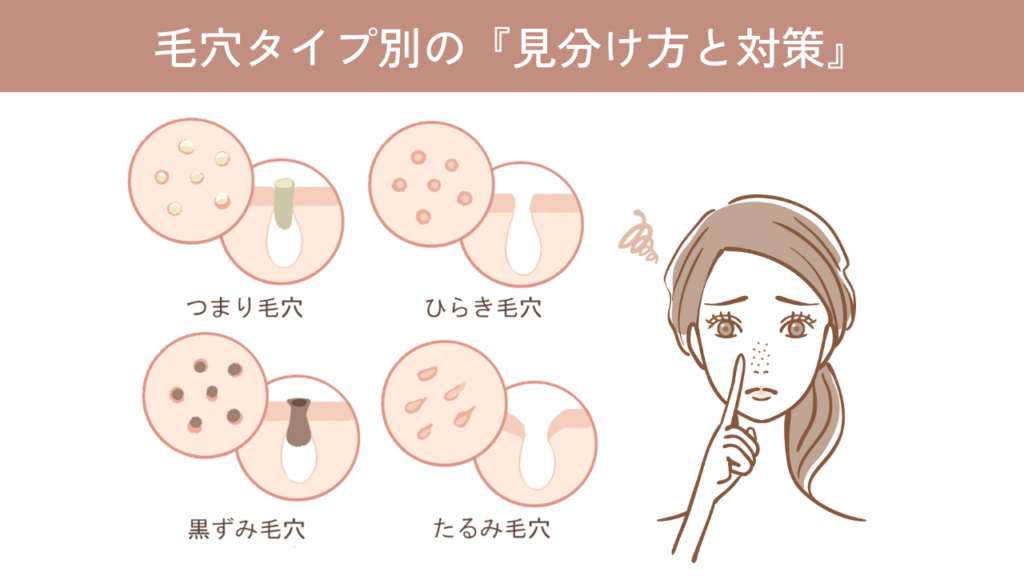 毛穴タイプ別の『見分け方と対策』